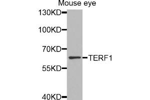 Western blot analysis of extracts of mouse eye, using TERF1 antibody.