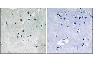 Immunohistochemistry analysis of paraffin-embedded human brain, using SRF (Phospho-Ser77) Antibody. (SRF antibody  (pSer77))