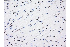 Immunohistochemical staining of paraffin-embedded liver tissue using anti-LOXmouse monoclonal antibody. (LOX antibody  (AA 22-168))