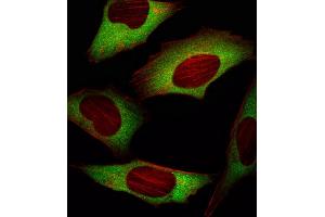 Fluorescent image of Hela cell stained with EIF4E Antibody (ABIN659032 and ABIN2838050)/SG101020AF. (EIF4E antibody)