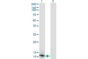Western Blot analysis of DYNLL1 expression in transfected 293T cell line by DYNLL1 monoclonal antibody (M02), clone 1H7. (DYNLL1 antibody  (AA 1-72))