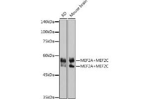 Western blot analysis of extracts of various cell lines, using MEF2A+MEF2C antibody (ABIN1679049, ABIN1679050, ABIN7101495 and ABIN7101496) at 1:1000 dilution. (MEF2A+MEF2C antibody)