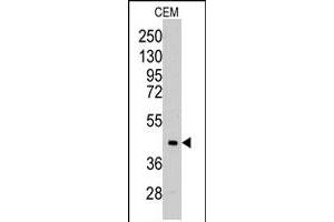 Western blot analysis of ALDOC polyclonal antibody  in CEM cell line lysates (35 ug/lane). (ALDOC antibody  (C-Term))