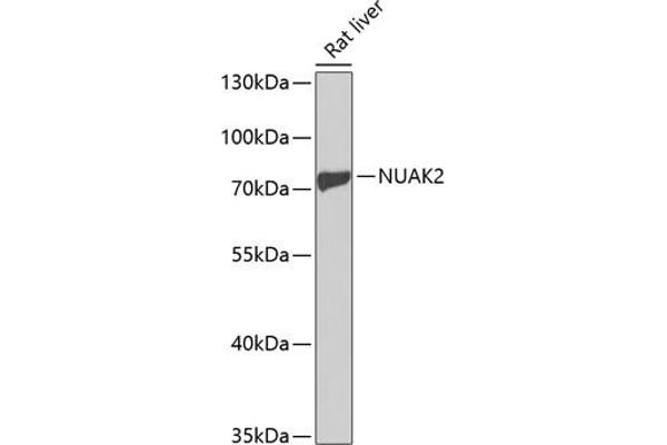 NUAK2 抗体  (AA 523-672)
