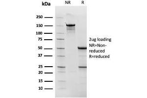 SDS-PAGE Analysis Purified Topo I, MT Mouse Monoclonal Antibody (TOP1MT/568). (TOP1MT antibody)