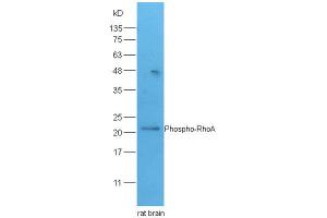 Lane 1: rat brain lysates probed with Rabbit Anti-RhoA(Ser188) Polyclonal Antibody, Unconjugated (ABIN758242) at 1:300 overnight at 4 °C. (RHOA antibody  (pSer188))