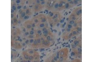 IHC-P analysis of Human Tissue, with DAB staining. (GLN1 antibody  (AA 1-373))