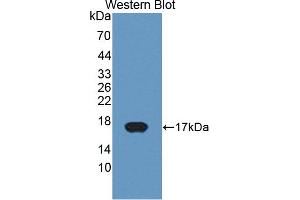Figure. (CYP11A1 antibody  (AA 391-515))