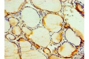 Immunohistochemistry of paraffin-embedded human thyroid tissue using ABIN7146163 at dilution of 1:100 (C3AR1 antibody  (AA 160-340))