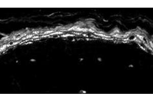 Nav1 (Nav1.8 antibody  (AA 1724-1956))