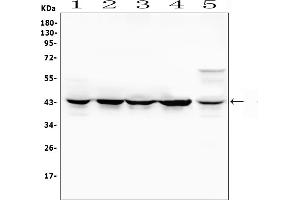 Western blot analysis of MAP2K4 using anti-MAP2K4 antibody (ABIN6719495). (MAP2K4 antibody  (AA 92-378))