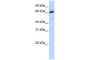 WB Suggested Anti-ARSH Antibody Titration:  0.