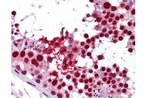 Immunohistochemistry (IHC) image for anti-KH Domain Containing, RNA Binding, Signal Transduction Associated 1 (KHDRBS1) (Middle Region) antibody (ABIN502004) (KHDRBS1 antibody  (Middle Region))