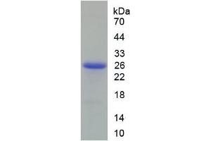 SDS-PAGE analysis of Rat Peroxiredoxin 6 Protein.