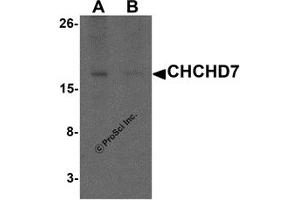 Western Blotting (WB) image for anti-Coiled-Coil-Helix-Coiled-Coil-Helix Domain Containing 7 (CHCHD7) (C-Term) antibody (ABIN1077411) (CHCHD7 antibody  (C-Term))