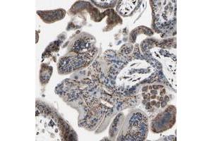 Immunohistochemical staining of human placenta with GLG1 polyclonal antibody  shows strong dot like cytoplasmic positivity in trophoblastic and decidual cells at 1:50-1:200 dilution. (GLG1 antibody)
