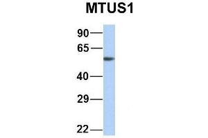 Host:  Rabbit  Target Name:  CHAD  Sample Type:  Human Adult Placenta  Antibody Dilution:  1. (MTUS1 antibody  (Middle Region))