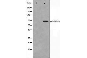 Western blot analysis on HepG2 cell lysate using MMP16 Antibody. (MMP16 antibody  (C-Term))