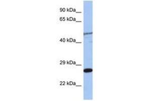 Image no. 1 for anti-MIS12, MIND Kinetochore Complex Component, Homolog (MIS12) (C-Term) antibody (ABIN6744257) (MIS12 antibody  (C-Term))
