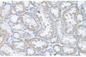 Immunohistochemistry (Paraffin-embedded Sections) (IHC (p)) image for anti-SNAIL (SNAI1) antibody (ABIN7255798)