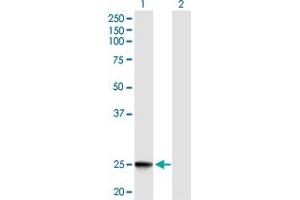 Western Blot analysis of IFNK expression in transfected 293T cell line by IFNK MaxPab polyclonal antibody. (IFNK antibody  (AA 1-207))