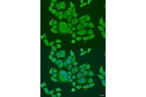Immunofluorescence analysis of U2OS cells using DHX58 antibody (ABIN6129372, ABIN6139609, ABIN6139610 and ABIN6224272) at dilution of 1:100.