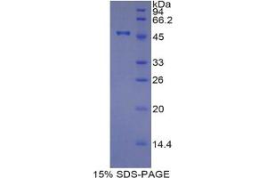 SDS-PAGE analysis of Pig TIMP4 Protein. (TIMP4 Protein)