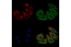ABIN6266210 and ABIN6277363 staining Hela cells by IF/ICC.