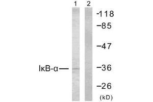 Western blot analysis of extracts from MCF7 cells using IκB-α (Ab-32/36) antibody (E021122). (NFKBIA antibody)