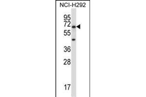 PODXL2 Antibody (C-term) (ABIN657525 and ABIN2846547) western blot analysis in NCI- cell line lysates (35 μg/lane). (PODXL2 antibody  (C-Term))