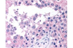 ATM antibody  (C-Term)