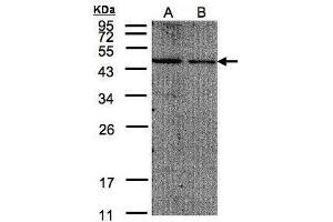 WB Image Sample(30 μg of whole cell lysate) A:293T B:A431, 12% SDS PAGE antibody diluted at 1:200 (EIF4A2 antibody  (N-Term))