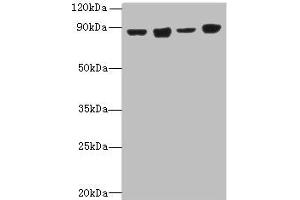 Western blot All lanes: DDX50 antibody at 4 μg/mL Lane 1: Hela whole cell lysate Lane 2: Jurkat whole cell lysate Lane 3: K562 whole cell lysate Lane 4: 293T whole cell lysate Secondary Goat polyclonal to rabbit IgG at 1/10000 dilution Predicted band size: 83 kDa Observed band size: 83 kDa (DDX5 antibody  (AA 1-210))