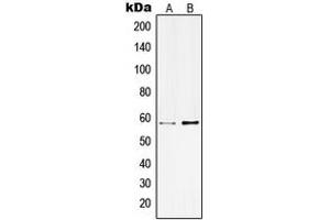 Western blot analysis of Kv3. (KCNC1 antibody  (Center))