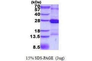 Figure annotation denotes ug of protein loaded and % gel used. (CD2 Protein (CD2))