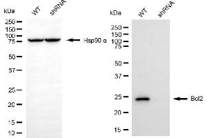 Western blotting analysis using Bcl2 antibody (ABIN7797721). (Recombinant Bcl-2 antibody)