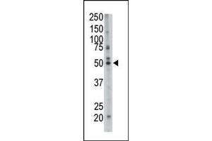 Western Blotting (WB) image for anti-Farnesyl-Diphosphate Farnesyltransferase 1 (FDFT1) (N-Term) antibody (ABIN357711) (FDFT1 antibody  (N-Term))