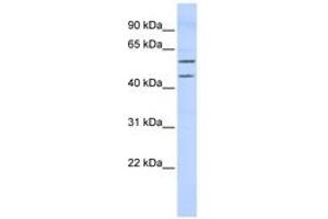 Image no. 1 for anti-T-Box 22 (TBX22) (AA 215-264) antibody (ABIN6742312) (T-Box 22 antibody  (AA 215-264))