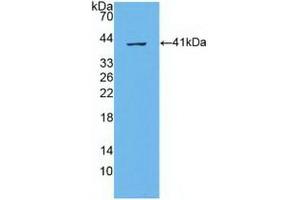 Western Blotting (WB) image for anti-ATP-Binding Cassette, Sub-Family A (ABC1), Member 4 (ABCA4) (AA 1398-1727) antibody (ABIN7441073)