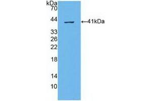 Detection of Recombinant ABCA4, Human using Polyclonal Antibody to ATP Binding Cassette Transporter A4 (ABCA4)