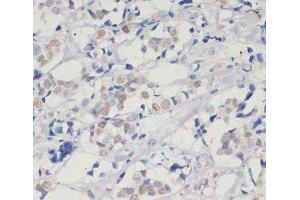 DNMT1 antibody