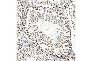 Immunohistochemistry of paraffin embedded mouse testis using PTPN3 (ABIN7075298) at dilution of 1:700 (300x lens) (PTPN3 antibody)