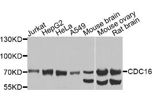 Western blot analysis of extracts of various cell lines, using CDC16 antibody (ABIN5974330) at 1/1000 dilution.