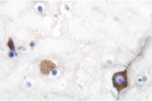 Immunohistochemistry Analysis: AP20199PU-N SYP antibody staining of Paraffin-Embedded Human brain tissue. (Synaptophysin antibody)