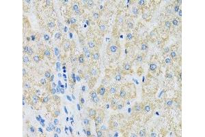 Immunohistochemistry of paraffin-embedded Human liver using SLC19A1 Polyclonal Antibody at dilution of 1:100 (40x lens). (SLC19A1 antibody)