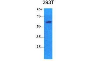Western Blotting (WB) image for anti-Pyruvate Kinase, Liver and RBC (PKLR) antibody (ABIN781545) (PKLR antibody)
