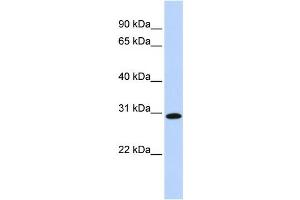 Western Blotting (WB) image for anti-Survival Motor Neuron Domain Containing 1 (SMNDC1) antibody (ABIN2458518) (SMNDC1 antibody)