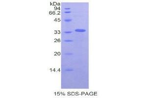 SDS-PAGE (SDS) image for Lysyl Oxidase-Like 4 (LOXL4) (AA 479-756) protein (His tag) (ABIN1080235) (LOXL4 Protein (AA 479-756) (His tag))