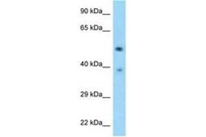 Image no. 1 for anti-tRNA-splicing Endonuclease Subunit SEN2 (TSEN2) (AA 395-444) antibody (ABIN6748165) (TSEN2 antibody  (AA 395-444))