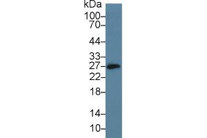 Western Blot; Sample: Mouse Small intestine lysate; Primary Ab: 5µg/ml Rabbit Anti-Mouse CD160 Antibody Second Ab: 0. (CD160 antibody  (AA 33-171))